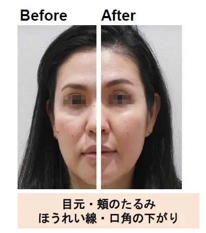 実感型ドクターズコスメSAIBOWシリーズ【Before & After】
