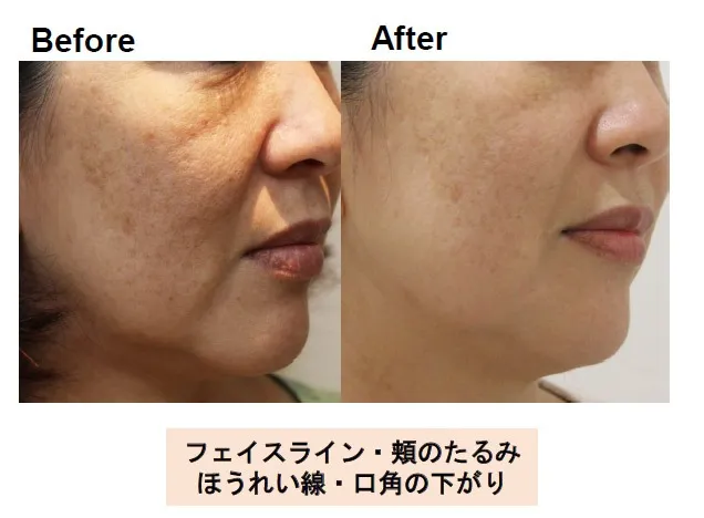 実感型ドクターズコスメSAIBOWシリーズ【Before & After】