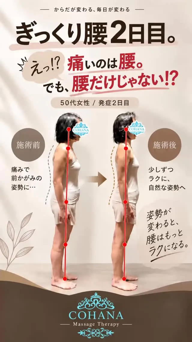 50代女性、ぎっくり腰発症2日目。